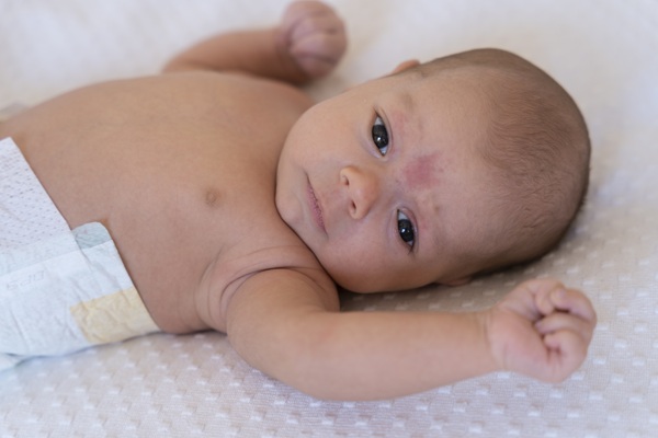 6 Common Health Problems & Diseases in Babies